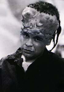 mumps.jpg (8582 bytes)