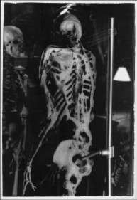 skele2.jpg (16787 bytes)