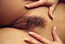 External genitalia - frontal view