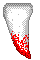 Tooth left
