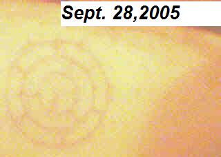 3-ring cross-hair marking