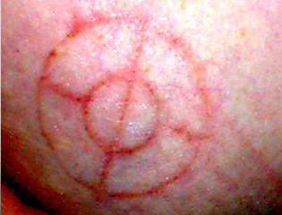 Enhanced Cross-Hair Marking