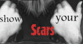 Show Your Scars