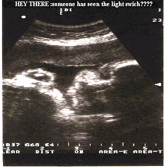 HEY THERE :someone has seen the light swich????