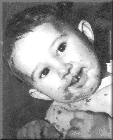 Kim 1975 Spaghetti Face